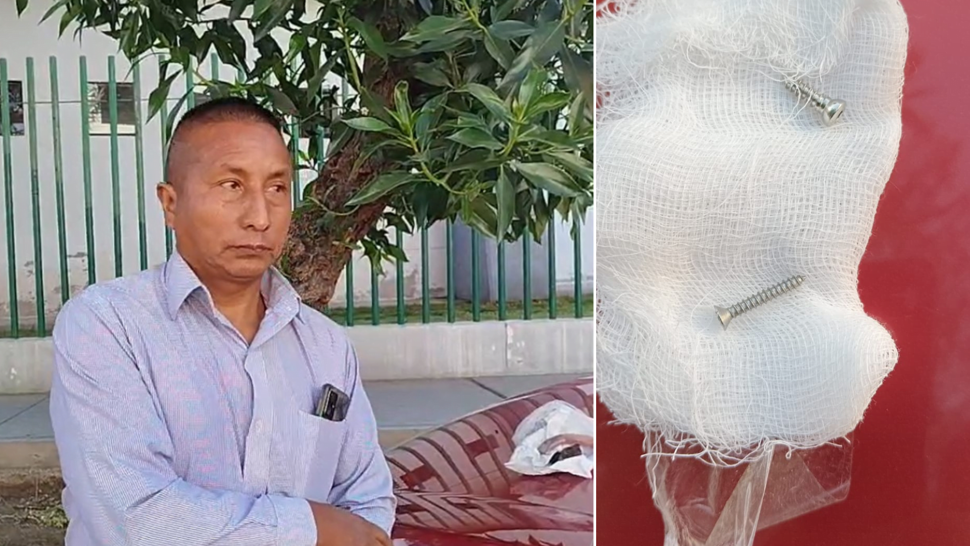 Arequipa: vecino denuncia a veterinaria por colocarle tornillos de construcción en la cadera de su perro peruano