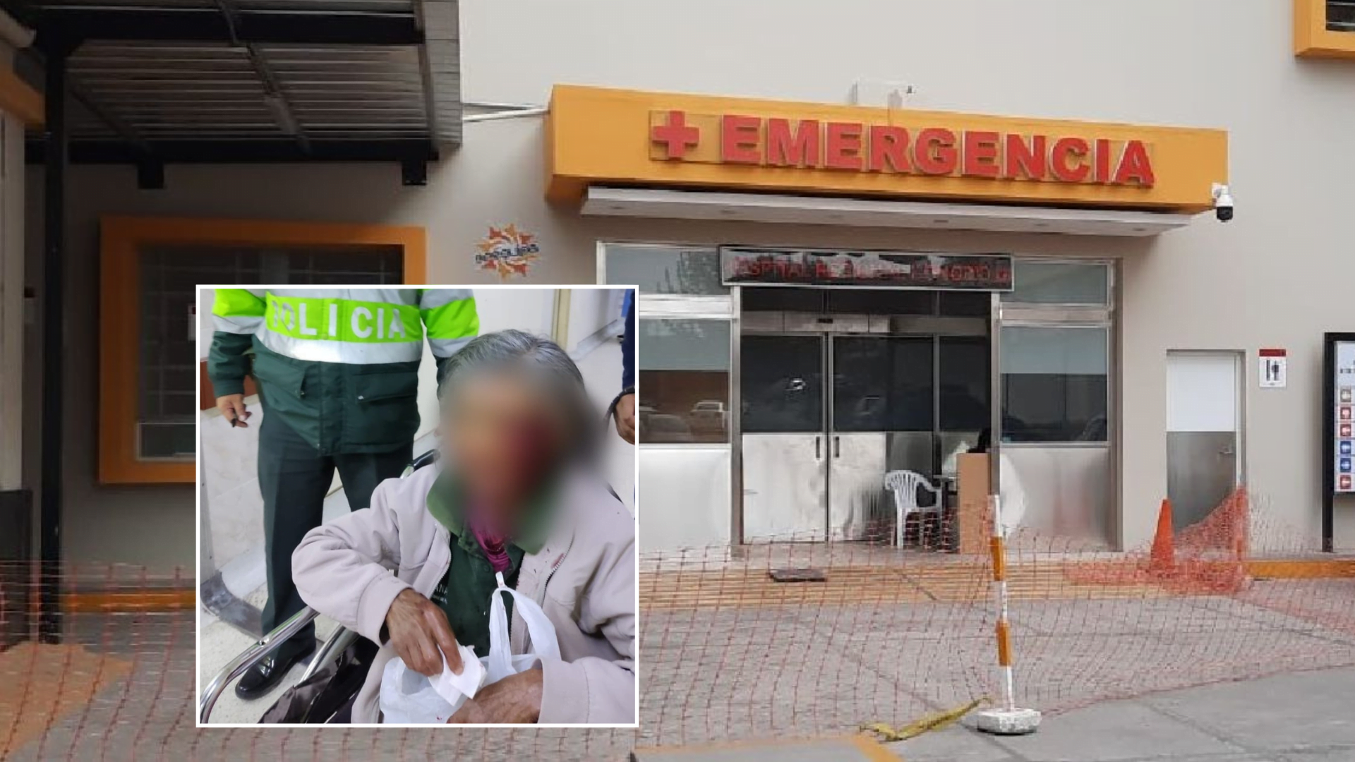 Arequipa: perro Pitbull atacó a anciana que defendió a sus mascotas del animal, dueño del can también quedó herido.