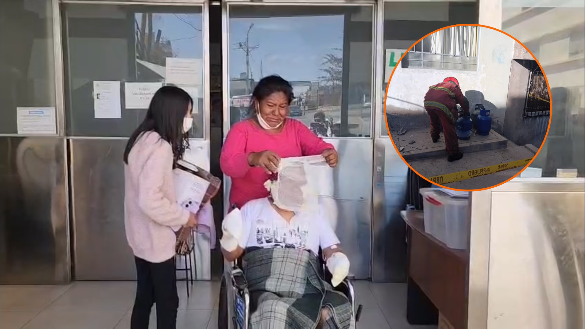 Grave denuncia: le dieron alta del hospital Honorio Delgado pese a graves quemaduras tras explosión en su casa 