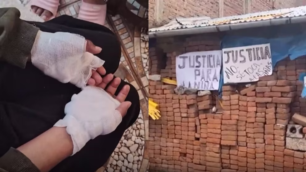 Indignación en Puno: exigen prisión preventiva para acusado de quemar a niña en Salcedo