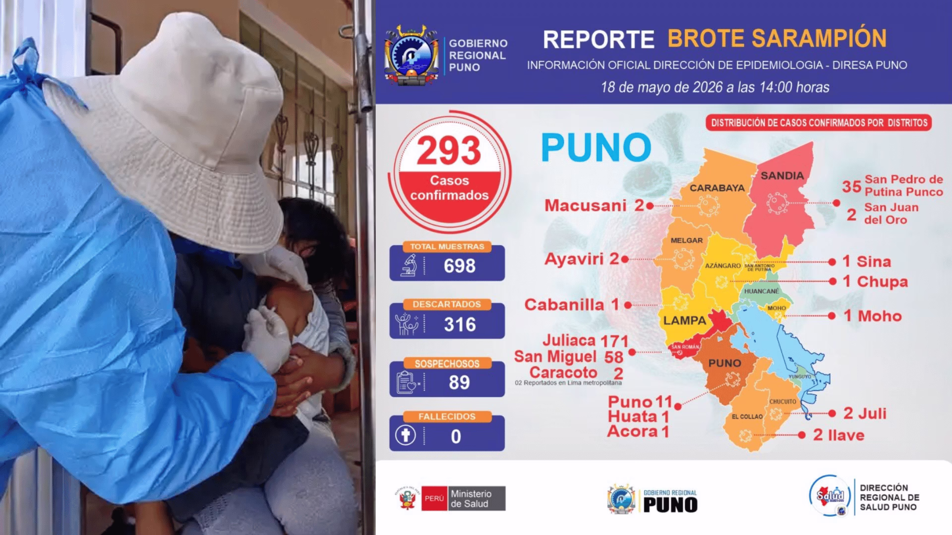 Sarampión en Puno: casos suben a 293 y Juliaca sigue siendo el principal foco de contagio.