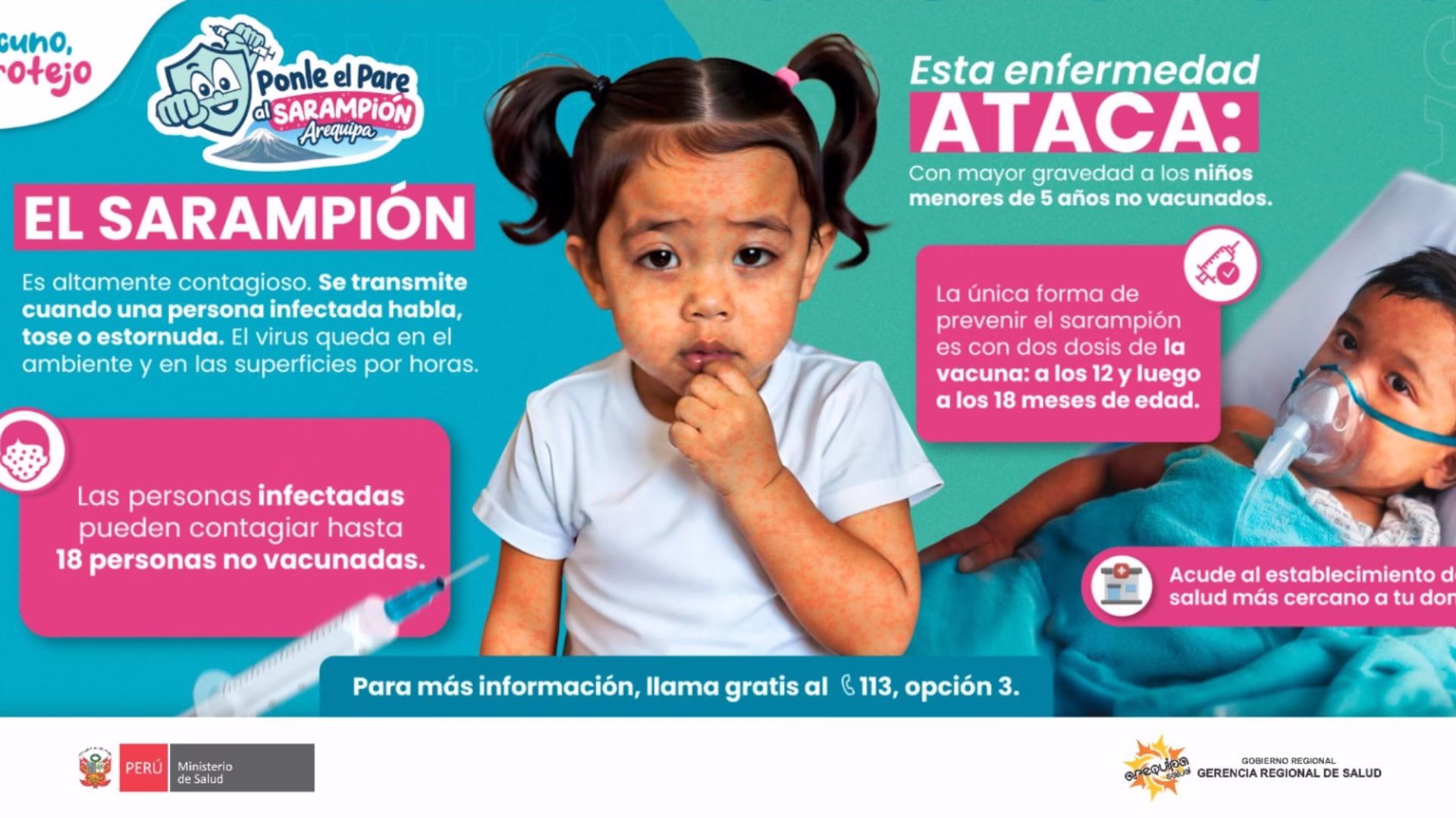 Arequipa confirma tercer caso importado de sarampión: bebé ingresó con neumonía a hospital de EsSalud 1 Arequipa confirma tercer caso importado de sarampión: bebé ingresó con neumonía a hospital de EsSalud