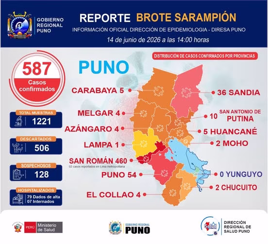 Diresa Puno alerta que 77% de casos de sarampión no contaba con vacuna 1 Diresa Puno alerta que 77% de casos de sarampión no contaba con vacuna 2026