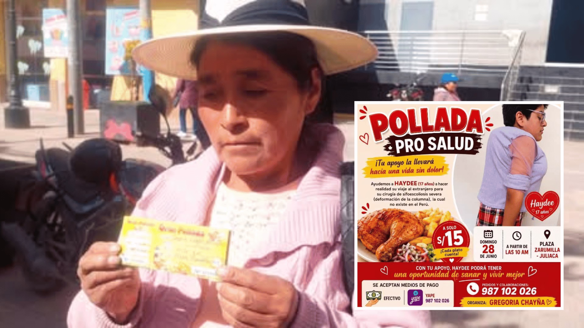 Juliaca: madre organiza pollada solidaria para costear la operación de su hija de 17 años.