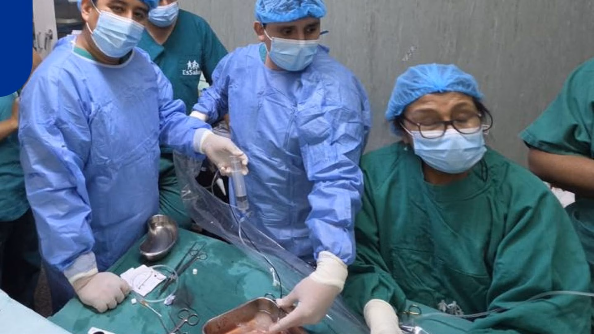 Arequipa: realizan cirugía pionera con láser en riñón fuera de un cuerpo, para trasplante en EsSalud 1 Arequipa: realizan cirugía pionera con láser en riñón fuera de un cuerpo, para trasplante