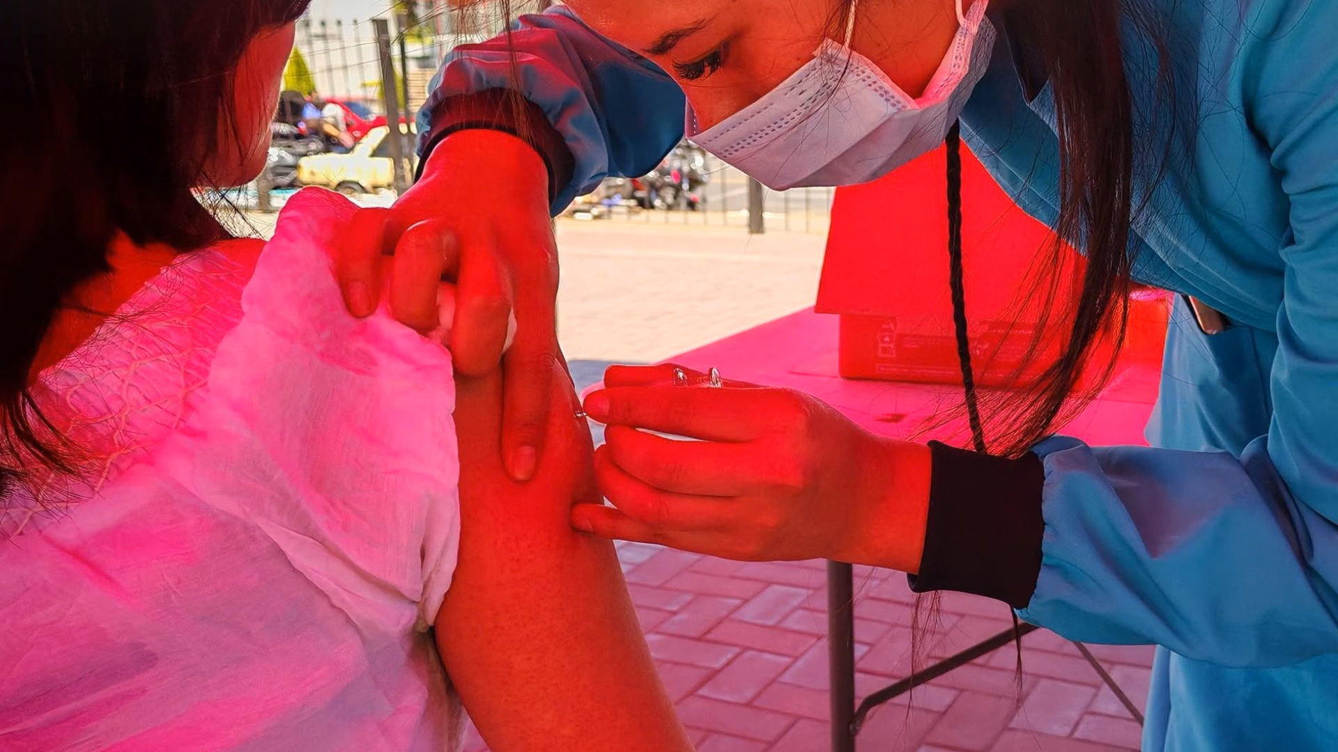 Arequipa supera los 490 casos confirmados de sarampión y Camaná con más de la mitad de pacientes 2 sarampión es una enfermedad altamente contagiosa, pero puede prevenirse mediante la vacunación.